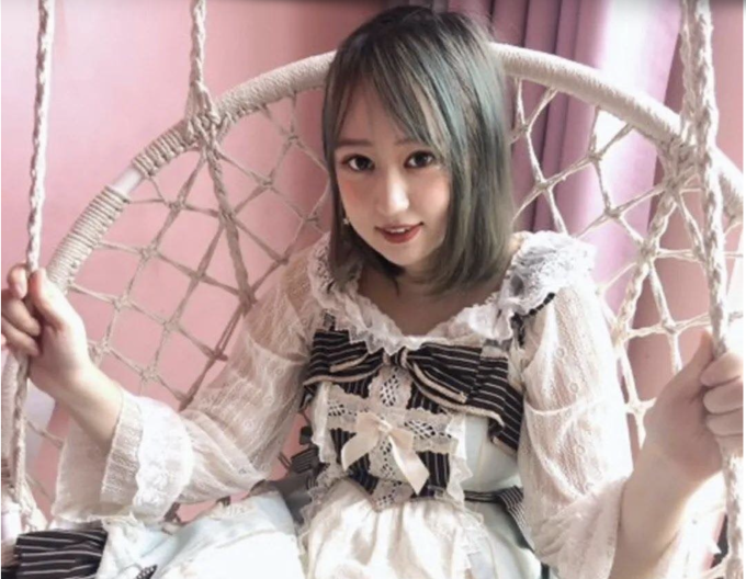 Zhou, Guozhi, 26 tuổi ở Bắc Kinh bị bạn bè, gíao viên miệt thị ngoại hình nên đã đi phẫu thuật thẩm mỹ. Ảnh: 36kr